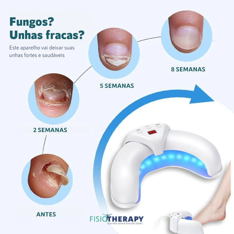 NailCare: Tratamento e Fortalecimento das Unhas com LED UV