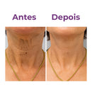 Neckfit - Adesivo para rugas e flacidez do pescoço