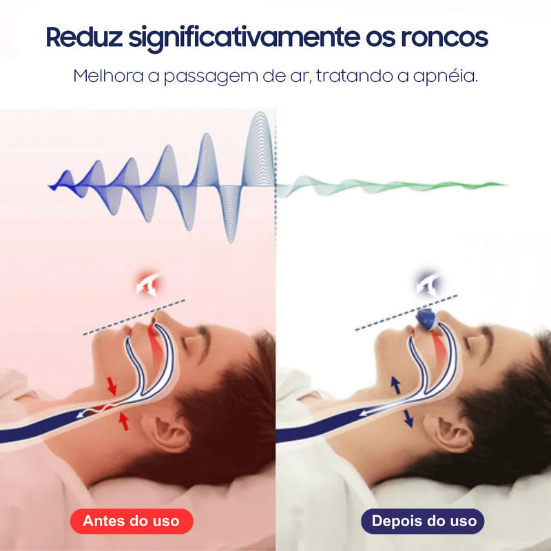 (COMPRE 1 LEVE 2) Dispositivo Eletrônico Mini-CPAP Anti-Roncos SonoFlux®