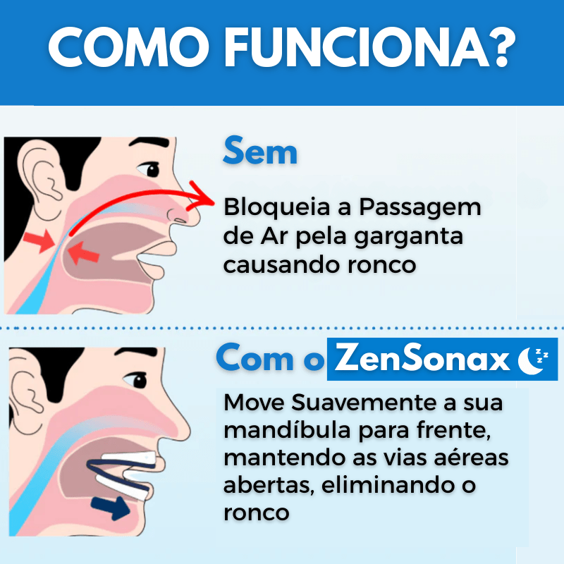 Protetor Bucal Anti-Ronco ZenSonax® - Ronco Nunca Mais!