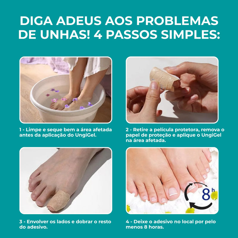 UngiGel - Adesivos para fungos